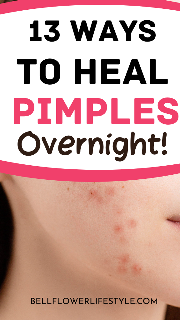 get rid of Pimples fast