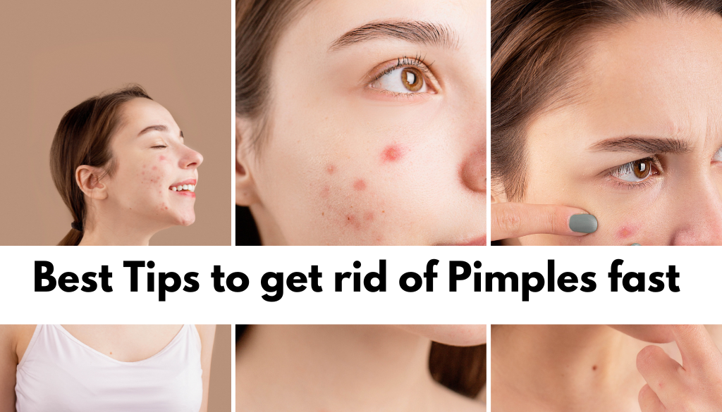 get rid of Pimples fast