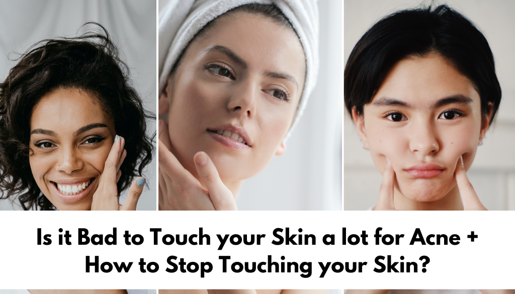 Is it Bad to Touch your Skin a lot for Acne + How to Stop Touching your Skin?